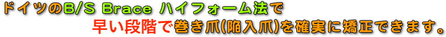 ドイツのB/S Brace ハイフォーム法で 痛い思いをすることなく巻き爪(陥入爪)を確実に矯正できます。
